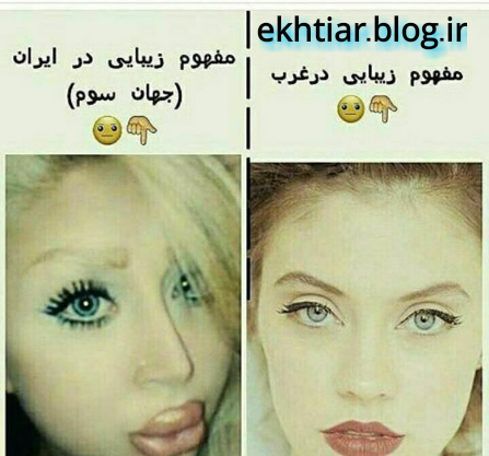 عکس قبل از عمل شاهیکا