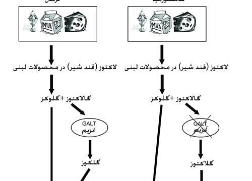 عکس بیماری گالاکتوزمی