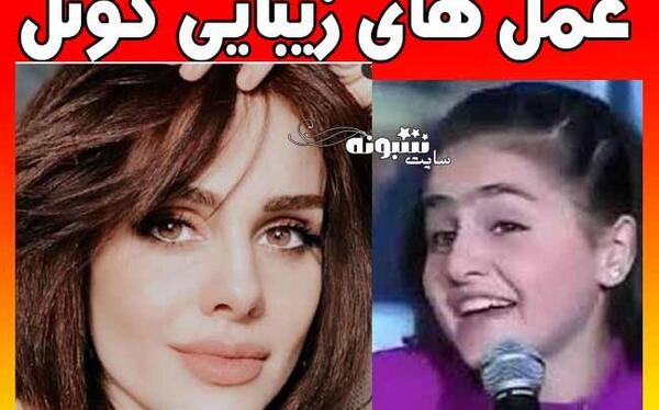 عکس قبل از عمل بازیگران ترکیه