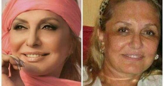 عکس قبل جراحی گوگوش
