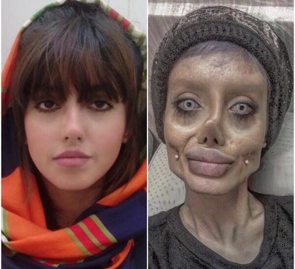 عکس قبل جراحی گوگوش