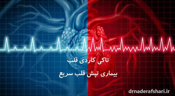 عکس نوشته نوار قلب