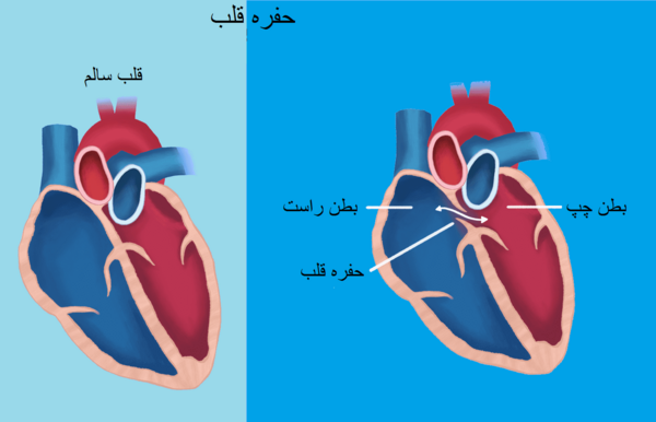 عکس قلب آدم