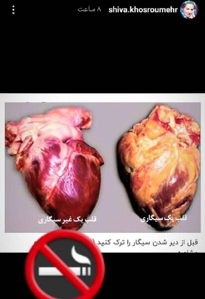 عکس قلب آدم