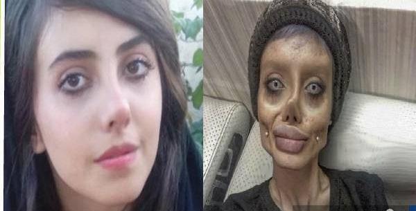 عکس سحر تبر قبل از عمل