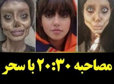 عکس سحر تبر قبل از عمل