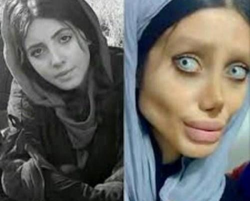 عکس سحر تبر قبل از عمل