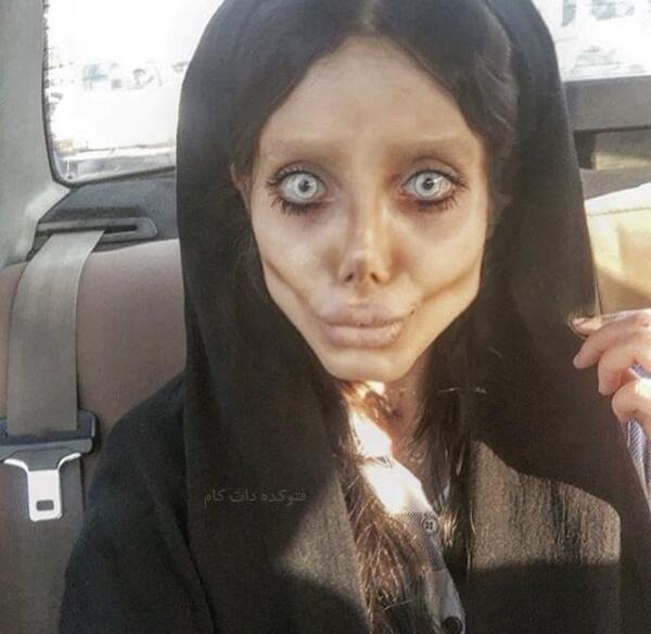 عکس سحر تبر قبل از عمل