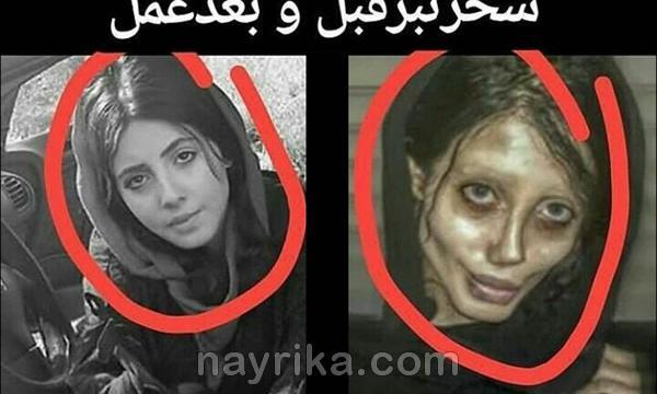 عکس سحر تبر قبل از عمل