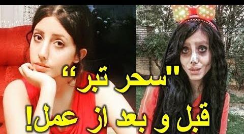 عکس سحر تبر قبل از عمل