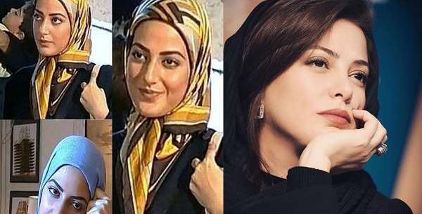 عکس طناز طباطبایی قبل از عمل بینی