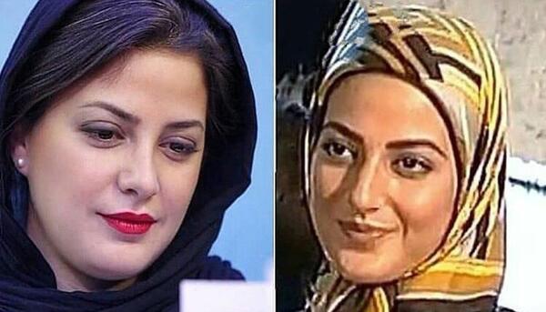 عکس طناز طباطبایی قبل از عمل بینی