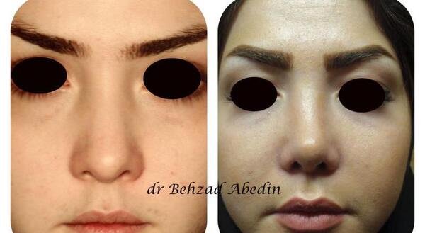 عکس بهزاد عابدینی
