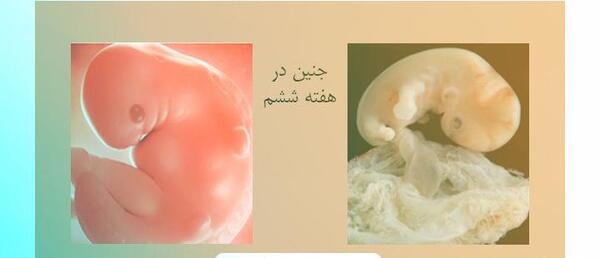 عکس قلب جنین در هفته ششم