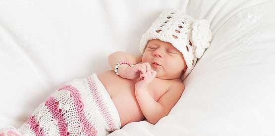 عکس نوزاد آنانسفالی