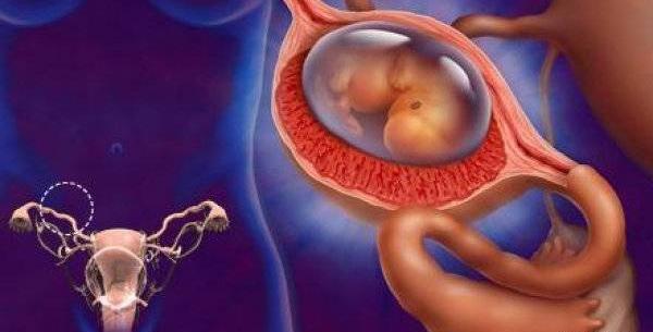 عکس بارداری خارج رحم