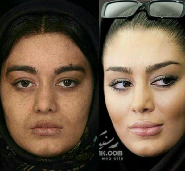 عکس سحر زکریا قبل عمل بینی