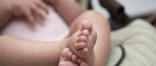عکس کبودی دور لب نوزاد