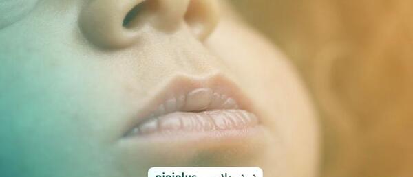عکس کبودی دور لب نوزاد