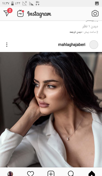 عکس آرزو جابری قبل از عمل