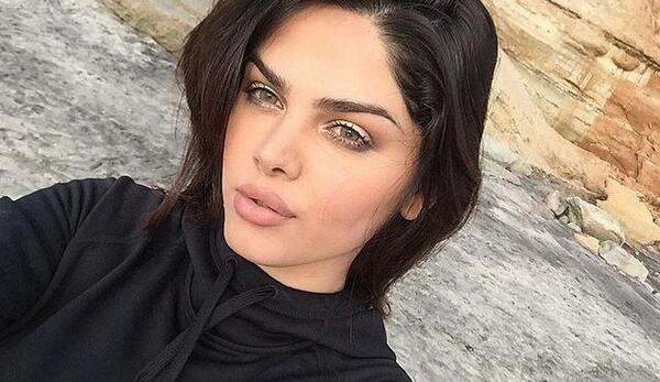 عکس آرزو جابری قبل از عمل
