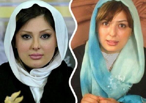 عکس قبل وبعدازعمل نیوشا ضیغمی