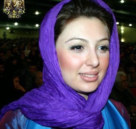 عکس قبل وبعدازعمل نیوشا ضیغمی