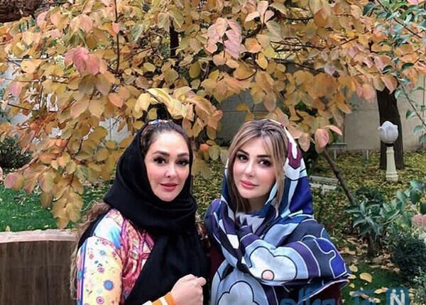 عکس قبل وبعدازعمل نیوشا ضیغمی