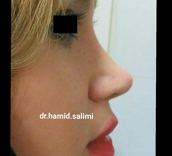 عکس حمید سلیمی