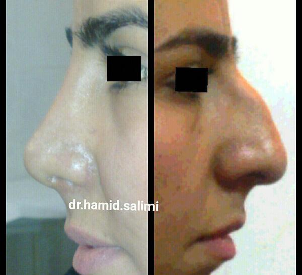 عکس حمید سلیمی