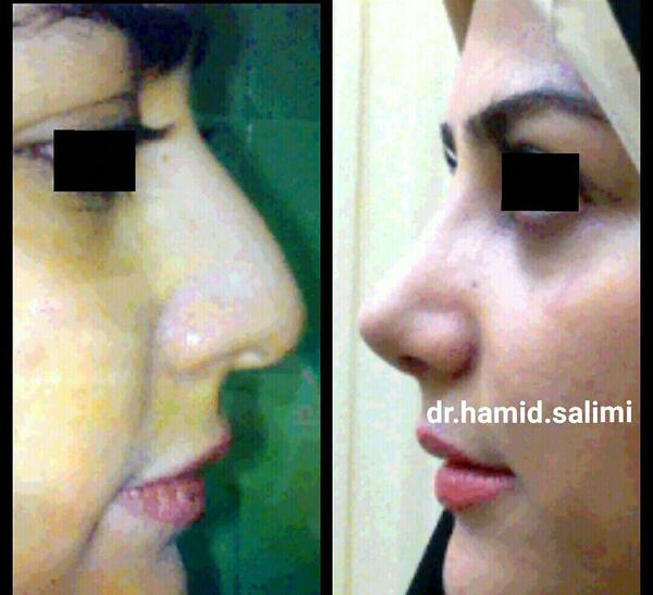 عکس حمید سلیمی