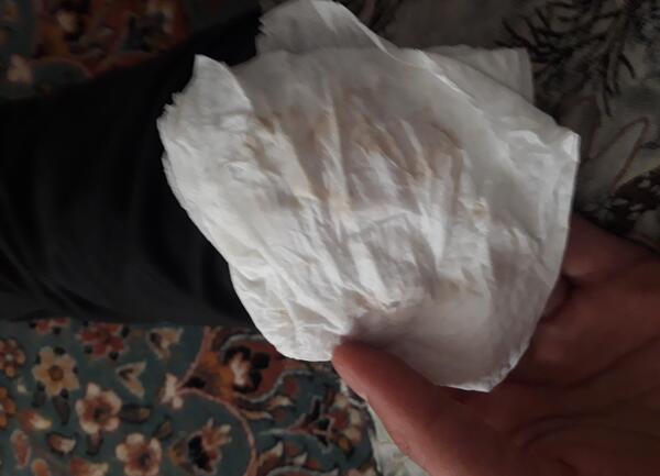 عکس لکه بینی در بارداری