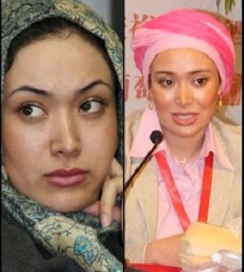 عکس باران قبل از عمل
