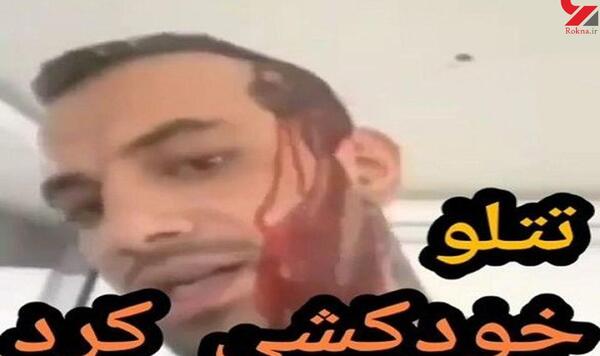 عکس های تتلو از بچگی تا الان