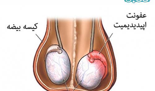 عکس مرد عقیم