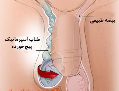 عکس مرد عقیم
