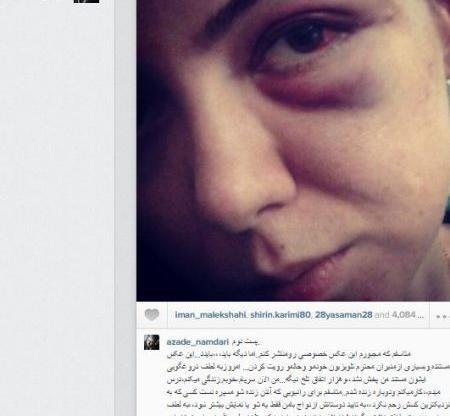 عکس لورفته ازاده نامدار