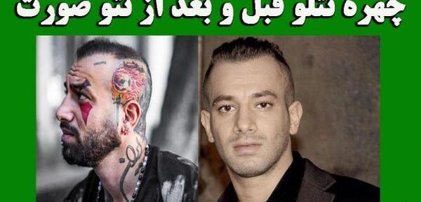 عکس های تتلو قبل از خالکوبی