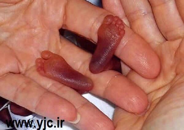 عکس بچه ی زشت