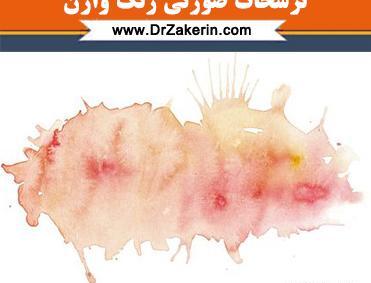 ترشحآت قهوه عکس لکه بینی قهوه ای در بارداری
