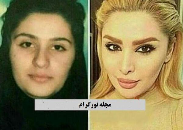 عکس قبل از عمل دنیا جهانبخت