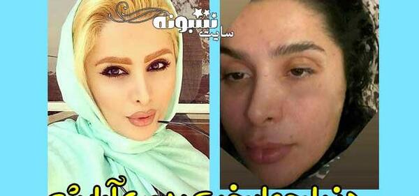 عکس قبل از عمل دنیا جهانبخت