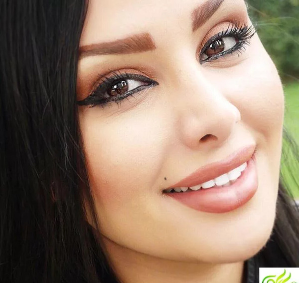 عکس قبل از عمل دنیا جهانبخت