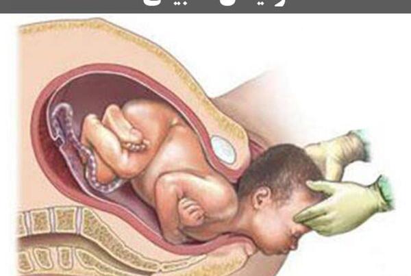 عکس زایمان طبیعی