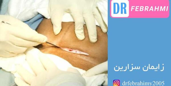 عکس زایمان طبیعی