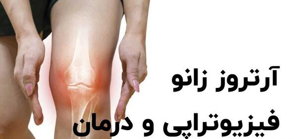 عکس سه بعدی زانو