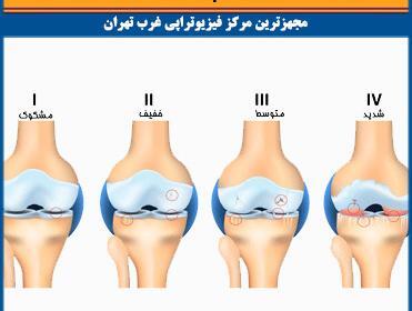 عکس سه بعدی زانو