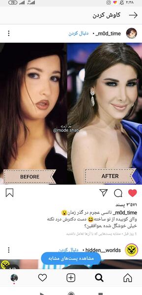 عکس نانسی قبل از عمل