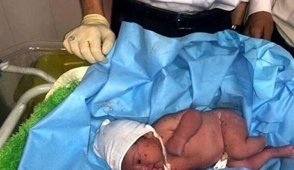 عکس نوزاد رها شده در خیابان