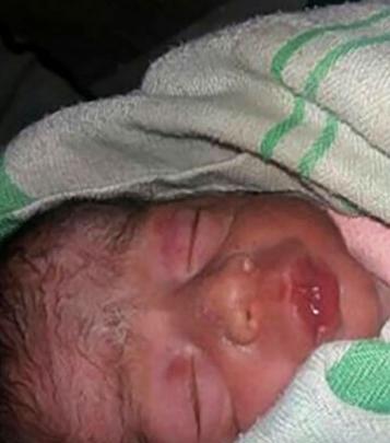 عکس نوزاد رها شده در خیابان